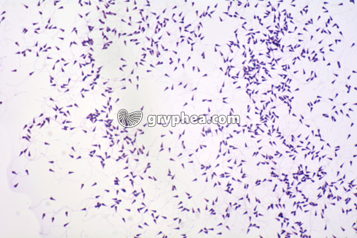 Oursin - Spermatozoïdes après coloration x100 - gryphea.com